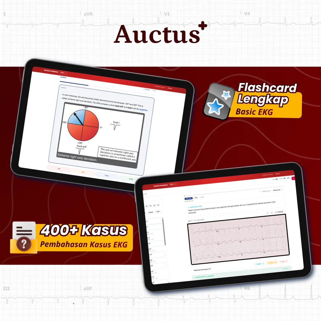 Flashcard Lengkap Basic EKG & 400+ Kasus